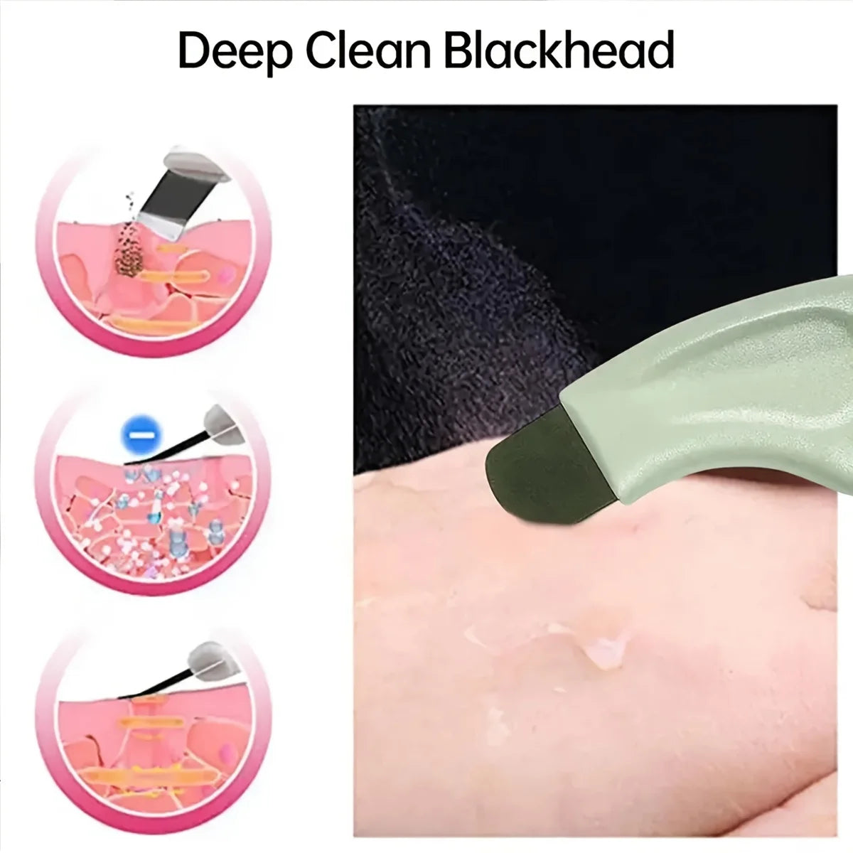 Facial Blackhead Removal Tool – Deep Cleansing for Clearer Skin